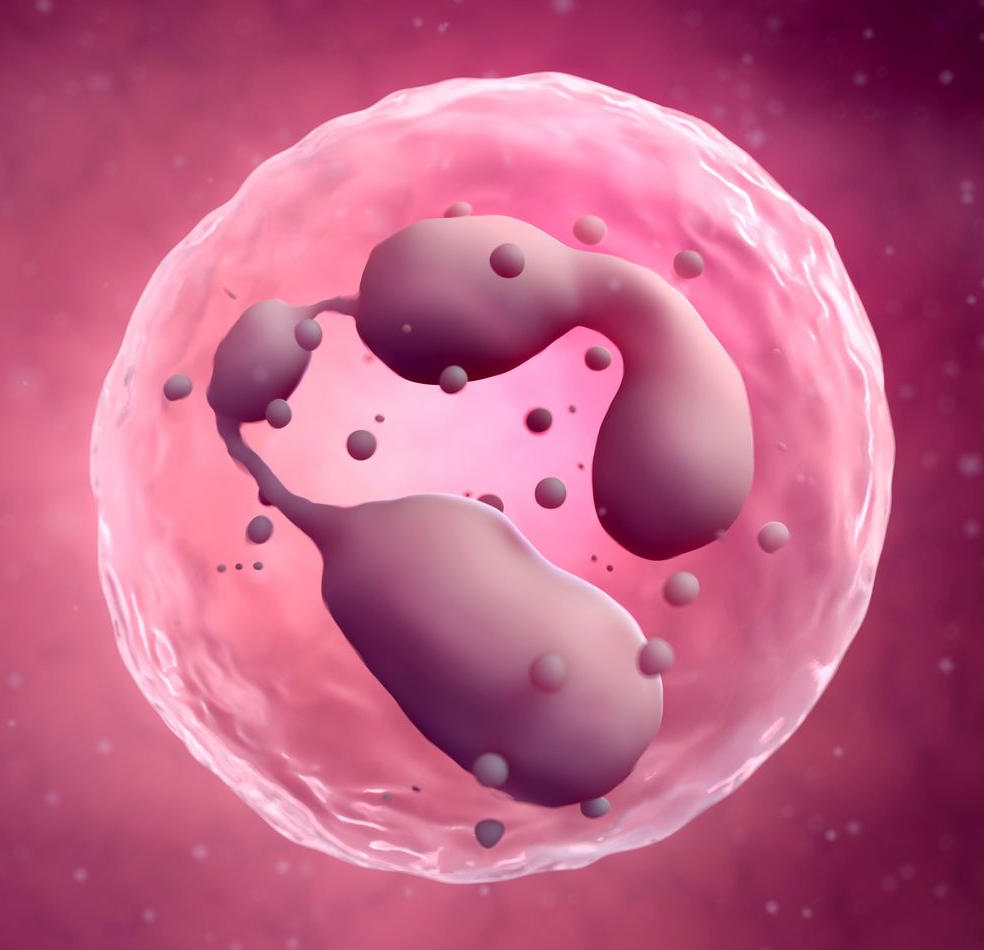 中性粒细胞在系统性红斑狼疮发病机制中的关键作用