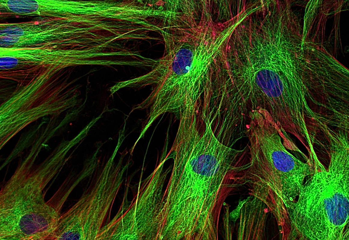 兔单克隆抗体进行B细胞分选的捷径：流式细胞术